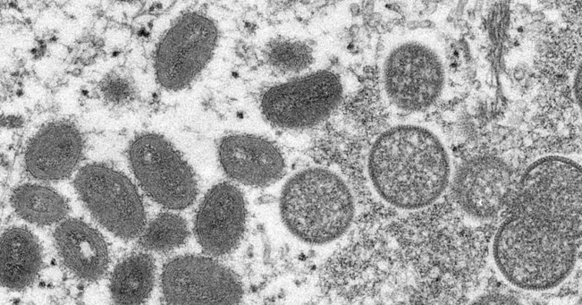 Reino Unido alerta para 8 novos casos de varíola dos macacos