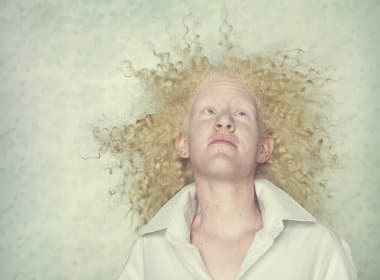Ensaio premiado do fotógrafo Gustavo Lacerda com albinos é lançado em livro