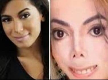 Anitta volta a ser criticada por cirurgias; no Twitter, cantora foi comparada a Michael Jackson