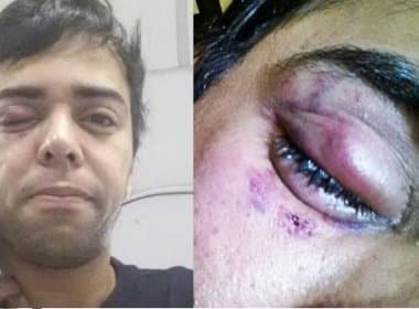 Ator é vítima de ataque homofóbico no Rio de Janeiro e tem visão comprometida 