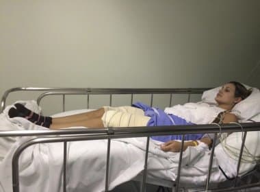 Agência divulga fotos da perna de Andressa Urach no hospital; imagens são fortes