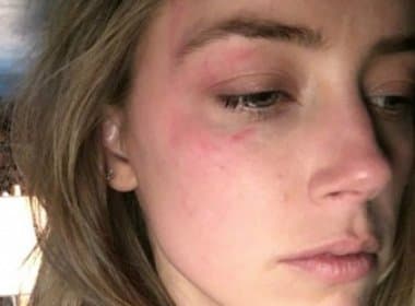 Amber Heard acusa Johnny Deep de agressão física e quer medidas protetivas da Justiça
