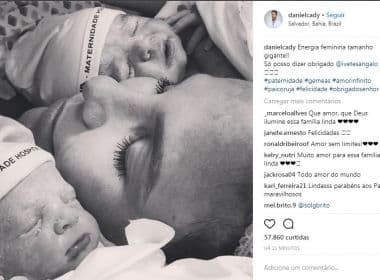 Daniel Cady posta foto de Ivete Sangalo com as gêmeas logo após o parto