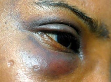 Lei Maria da Penha: Bahia registra 2,4 mil atos de violência contra mulheres em 6 meses