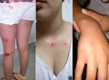 OAB-BA lança nota de repúdio a vereador que agrediu adolescente em Firmino Alves