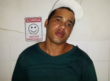 Polícia de Ibirataia pede prisão preventiva de homem suspeito de agredir companheira