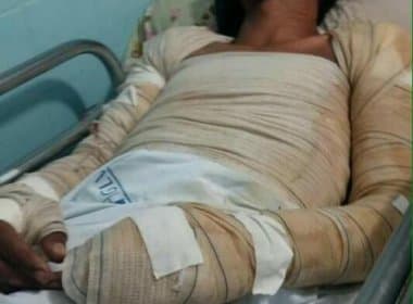 Itacaré: Morre artesão queimado em barraca enquanto dormia