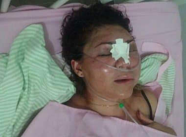 Ibiassucê: Mulher tem insuficiência respiratória após agressão de ex-marido 
