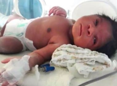 Lauro de Freitas: Bebê encontrado em saco de lixo tem alta médica 