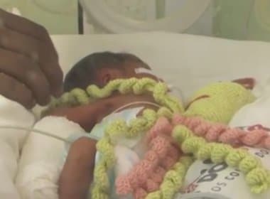 Feira: Hospital usa bonecos em formato de polvo em terapia de bebês prematuros