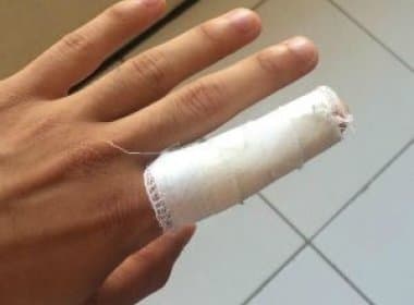 Estudante tem dedo torcido após recusar troco de R$ 37,50 em chocolates