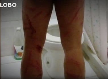 Soldado denuncia tortura no Exército do Rio de Janeiro que levou a remoção de testículo