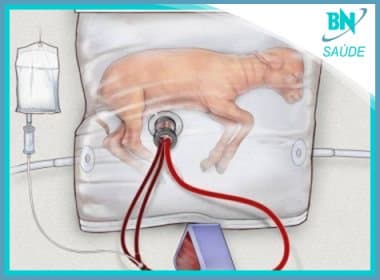 Destaque em Saúde: Bolsa com fluido busca ampliar sobrevivência de bebês prematuros
