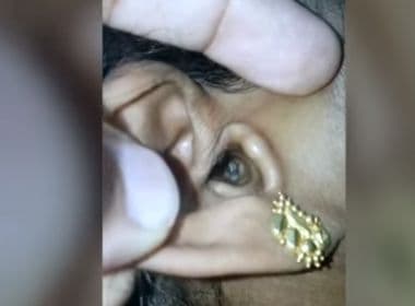 Após ter fortes dores de cabeça, mulher descobre que tinha aranha viva em seu ouvido