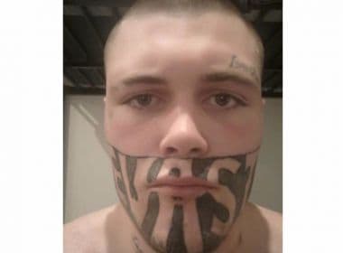 Jovem ganha tratamento para remover tatuagem no rosto feita enquanto estava preso