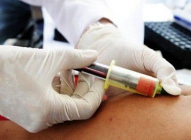Lacen passa a realizar exame em tempo real para detectar vírus HPV 