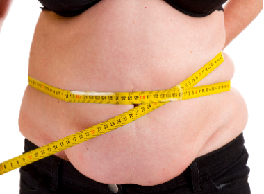 Pesquisa aponta que o índice de pessoas que voltam a engordar após bariátrica chega a 20%