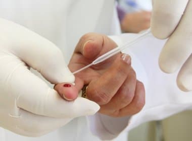 Com alto número de casos de Aids, Subúrbio recebe mutirão de teste gratuito de HIV