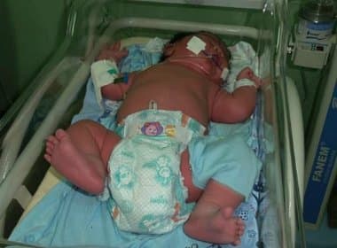 Bebê prematuro nasce com 6,7 kg em maternidade do Amazonas