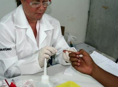 Posto de Santo Inácio faz testes rápidos para HIV, sífilis e hepatites