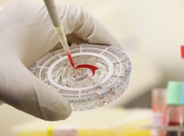 OMS testará vacina contra ebola na África em janeiro