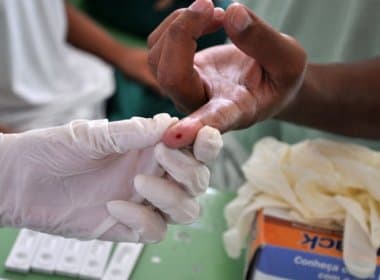 SUS pode oferecer novo tratamento contra hepatite C em 2015