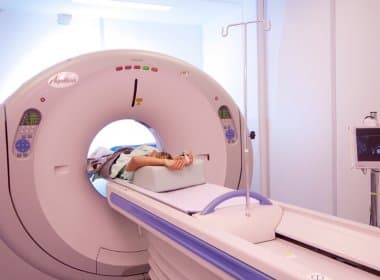 Tomografia que permite diagnóstico mais detalhado de câncer é incluída à lista do SUS