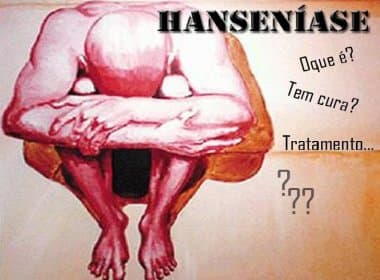 Salvador registra aumento de 20% nos casos de hanseníase