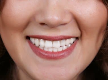 Sorrir ajuda a melhora dor dente, aponta estudo