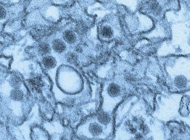 Pesquisadores franceses encontram relação entre zika e síndrome de Guillain-Barré