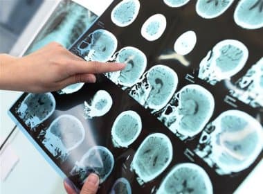 Cientistas vão tentar ressuscitar pacientes que tiveram morte cerebral