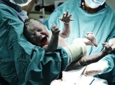 ‘Cesariana natural’ faz bebê sair de útero sozinho; veja vídeo