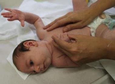 Ministério da Saúde confirma 1.749 casos de microcefalia em todo o Brasil