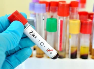 Por falta de precisão nos exames diagnósticos a epidemia de Zika no país pode ser subestimada 