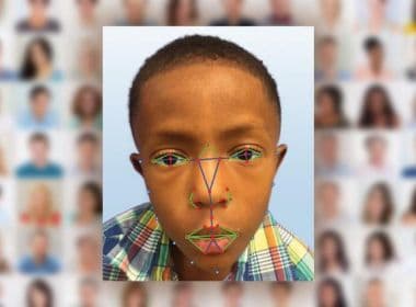 Cientistas criam software que identifica doença rara por meio de reconhecimento facial