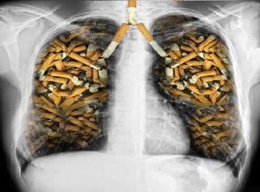 ‘Você morre’: Anvisa quer mensagens diretas nos cigarros