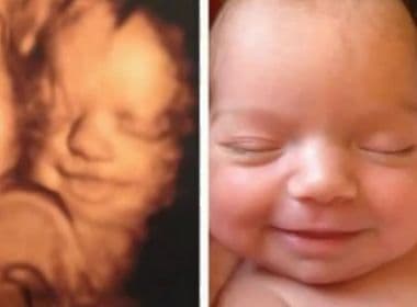 Médico usa ultrassom 4D para comparar bebês antes e depois do parto