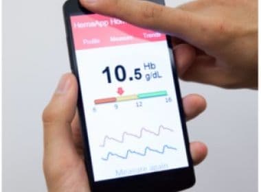 Google compra startup que criou aplicativo para detecção de doenças via smartphone