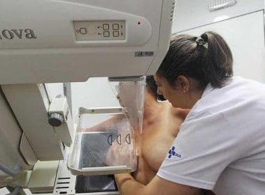 Sede da 40ª CIPM, no Nordeste de Amaralina, oferece exames de mamografia gratuitos