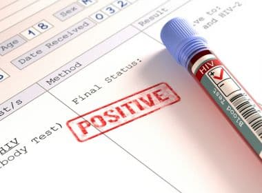 Menos da metade dos infectados por HIV e tuberculose tomam antirretroviral, aponta OMS
