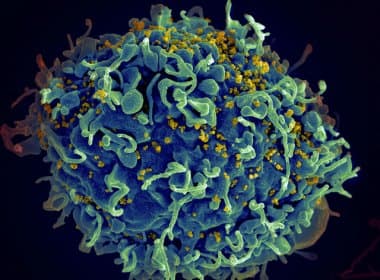 Mitos e verdades: Tire suas dúvidas sobre a transmissão do HIV