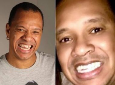 Cantor do Molejo faz tratamento dentário de R$ 100 mil e desfila novo visual