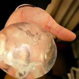 Brasileiras com silicone serão cadastradas e rastreadas por médicoss