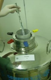 Fertilização in vitro poderá ganhar cobertura pelo SUS até o fim do ano