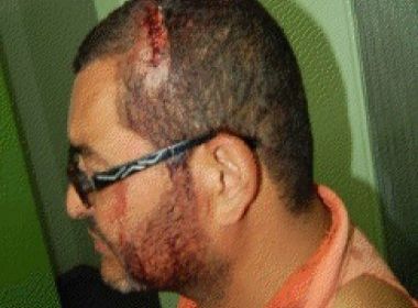 Ibicoara: caminhada pela paz vira palanque político e acaba em agressão