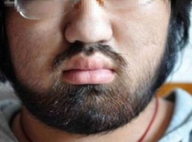 Chinesa de 16 anos não sai de casa por ter barba e bigode