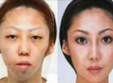  Chinês ganha indenização de R$ 245 mil após descobrir que esposa fez cirurgia plástica