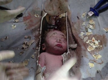 Bebê encontrado em tubulação de esgoto recebe alta na China