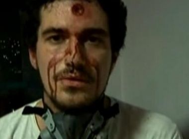 RJ: Repórter é atingido na testa em protesto