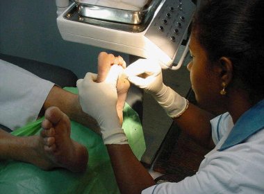 Projeto em Salvador sensibiliza população para exame do 'pé diabético'
